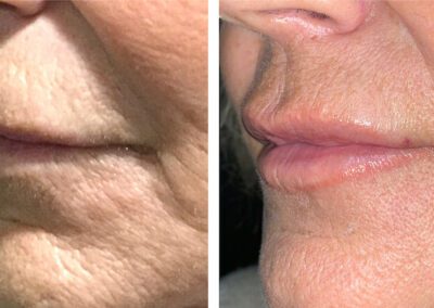 result of treatment can be seen on the before and after images